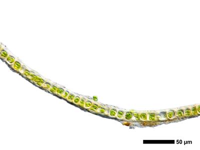 gymnomitrion alpinum 1 flankenblatt quer detail