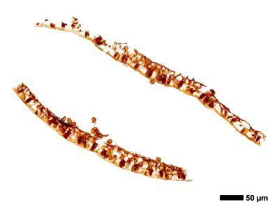 gymnomitrion alpinum 1 kapsel quer