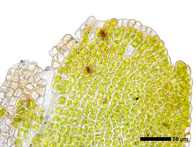 gymnomitrion alpinum 1 perianthmuendung