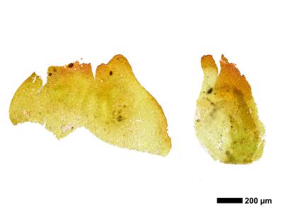 gymnomitrion alpinum 1 perigynium calyptra
