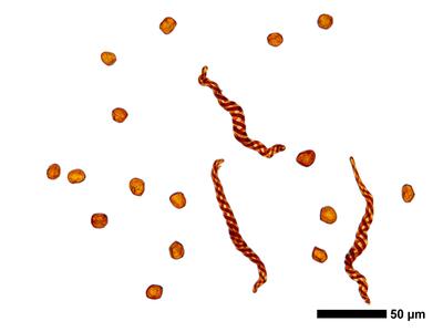 gymnomitrion alpinum 1 sporen elateren
