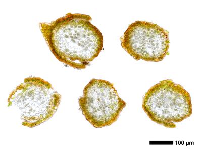 gymnomitrion alpinum 1 staemmchen quer