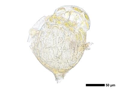 gymnomitrion brevissimum 1 antheridium