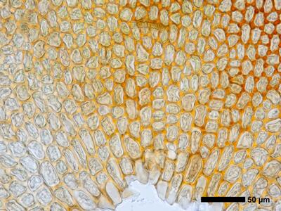 gymnomitrion brevissimum 1 flankenblatt blattbasis