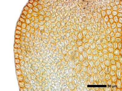gymnomitrion brevissimum 1 flankenblatt blattrand