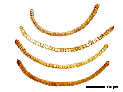 gymnomitrion brevissimum 1 flankenblatt quer