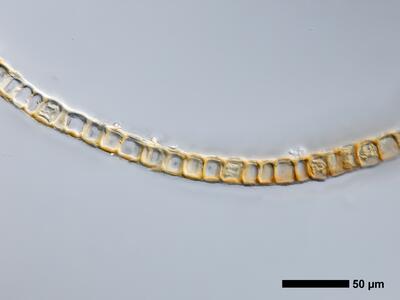 gymnomitrion brevissimum 1 flankenblatt quer detail