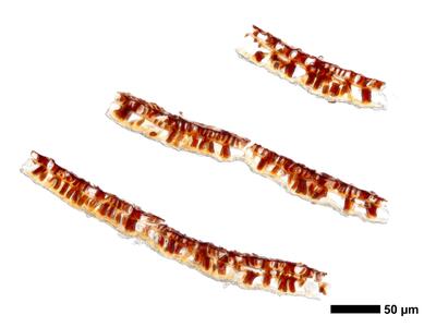 gymnomitrion brevissimum 1 kapsel quer