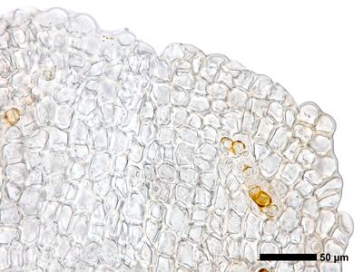 gymnomitrion brevissimum 1 perianthmuendung