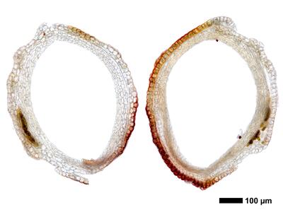 gymnomitrion brevissimum 1 perigynium basis quer