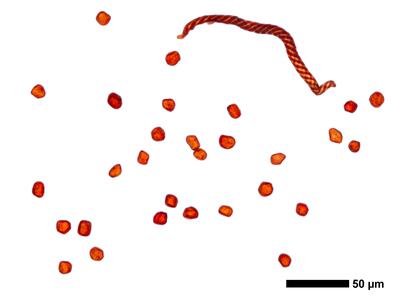 gymnomitrion brevissimum 1 sporen elateren