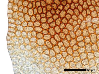gymnomitrion commutatum 1 flankenblatt blattrand