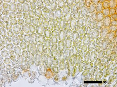 gymnomitrion concinnatum 1 flankenblatt blattbasis