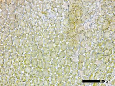 gymnomitrion concinnatum 1 flankenblatt blattmitte
