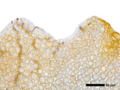 gymnomitrion concinnatum 1 flankenblatt blattspitze