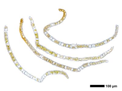 gymnomitrion concinnatum 1 flankenblatt quer