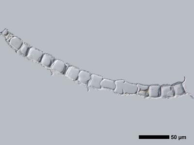 gymnomitrion concinnatum 1 flankenblatt quer detail