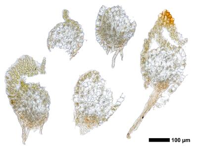gymnomitrion concinnatum 1 staemmchen quer