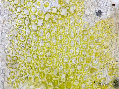 gymnomitrion concinnatum flankenblatt blattmitte