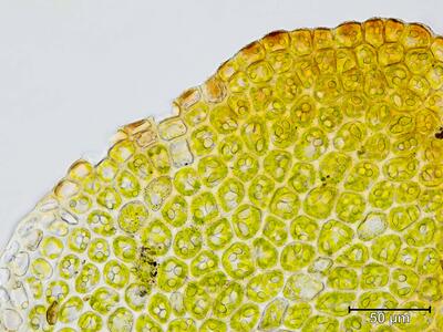 gymnomitrion concinnatum zellen