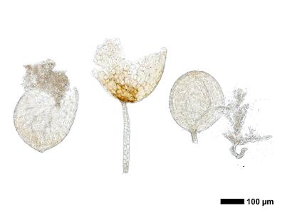 gymnomitrion obtusum 1 antheridien