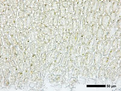 gymnomitrion obtusum 1 flankenblatt blattbasis