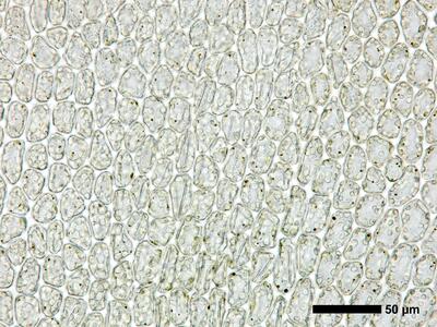gymnomitrion obtusum 1 flankenblatt blattmitte