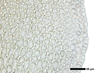 gymnomitrion obtusum 1 flankenblatt blattrand