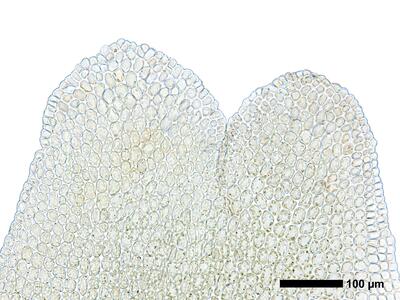 gymnomitrion obtusum 1 flankenblatt blattspitze