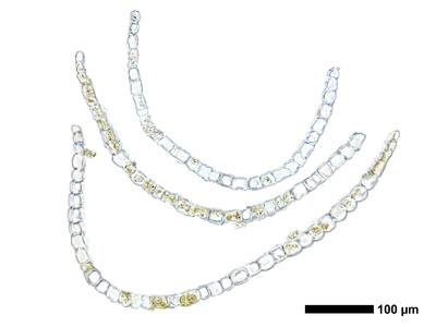 gymnomitrion obtusum 1 flankenblatt quer