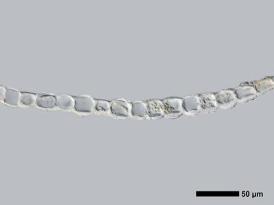 gymnomitrion obtusum 1 flankenblatt quer detail