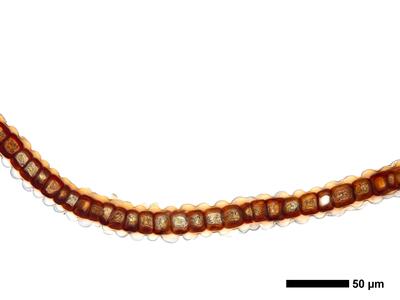 gymnomitrion revolutum 1 flankenblatt quer detail