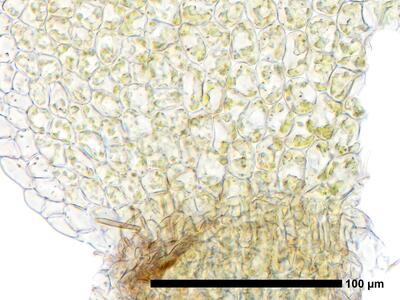 marsupella apiculata 1 flankenblatt blattbasis