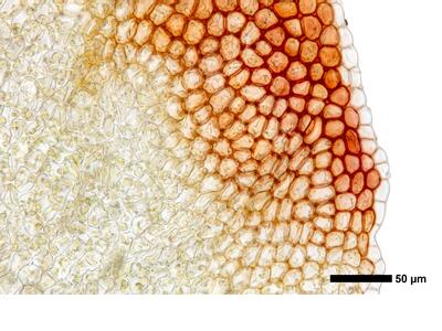 marsupella apiculata 1 flankenblatt blattrand