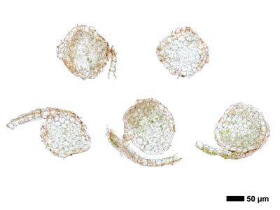 marsupella apiculata 1 staemmchen quer
