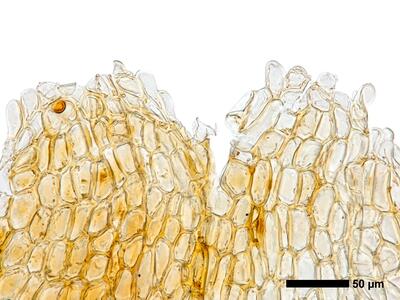 marsupella apiculata 2 perianthmuendung