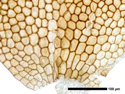 marsupella boeckii 1 flankenblatt blattbasis