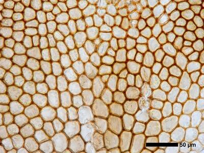 marsupella boeckii 1 flankenblatt blattmitte