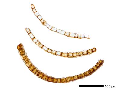 marsupella boeckii 1 flankenblatt quer