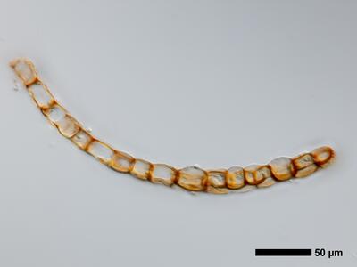 marsupella boeckii 1 flankenblatt quer detail