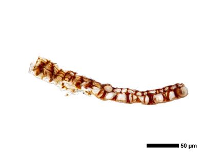 marsupella boeckii 1 kapsel quer