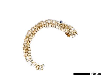 marsupella boeckii 1 perigynium basis quer