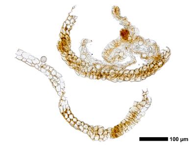 marsupella boeckii 1 perigynium mitte quer