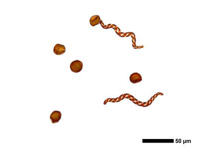 marsupella boeckii 1 sporen elateren