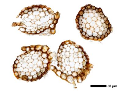 marsupella boeckii 1 staemmchen quer