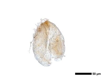 marsupella condensata 1 antheridium