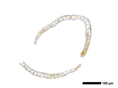 marsupella condensata 1 perianth quer