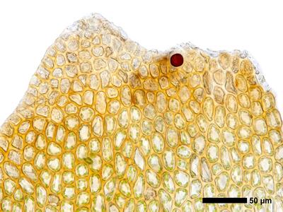 marsupella condensata 1 perianthmuendung