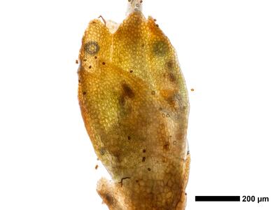 marsupella condensata 1 perigynium