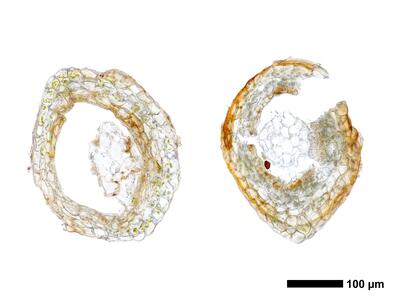 marsupella condensata 1 perigynium basis quer